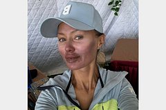 Viktorija bonja pokazala krupnym planom obgorevshee lico s gerpesom na gubah c869c03.jpg