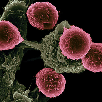Nature medicine ispytanija novyh vidov terapii raka stanut sobytiem 2025 goda 7bb34e6.jpg