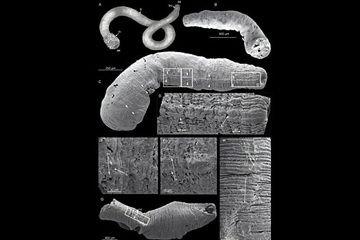 Raskryt sekret evoljucii nervnoj sistemy u drevnih nematod i penisnyh chervej c67f21a.jpg