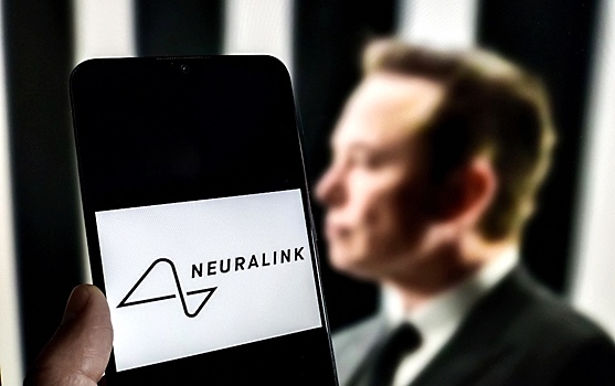 Neuralink maska privlekla 650 mln na ispytanija mozgovyh implantov d8c5100.jpg